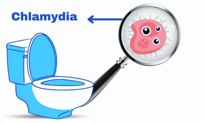 get-chlamydia-from-a-toilet-seat
